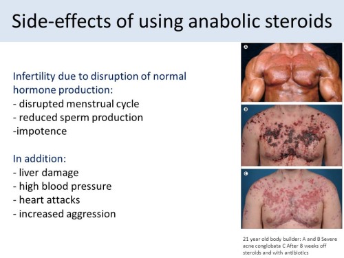 Why testosterone steroids Is A Tactic Not A Strategy