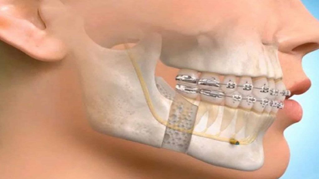 Oral and Maxillofacial Surgeon by Dr Sanchaita Kohli - Ourboox.com Oral and Maxillofacial Surgeon by Dr Sanchaita Kohli - Ourboox.com
