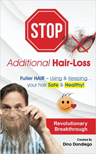 Stop Additional Hair Loss: Fuller Hair: Using and Keeping Your Hair Safe and Healthy Paperback – May 20, 2022 by Dino Dondiego - Ourboox.com Stop Additional Hair Loss: Fuller Hair: Using and Keeping Your Hair Safe and Healthy Paperback – May 20, 2022 by Dino Dondiego - Ourboox.com