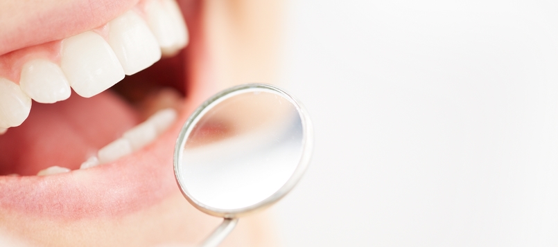 Beneficios-de-ir-al-dentista