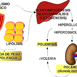 porque hay polifagia en la diabetes