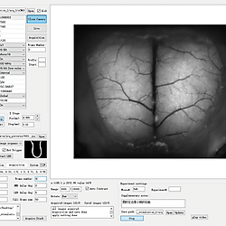 Neuron Data from MFIAS