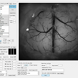 Neutrophil Data from MFIAS