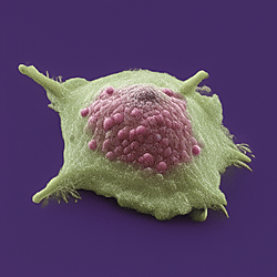 PANI biosensor
