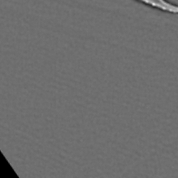 The genomandibular gland of <i>Nasonia giraulti</i> (Hymenoptera: Pteromalidae).