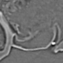 The genal gland of <i>Nasonia giraulti</i> (Hymenoptera: Pteromalidae)