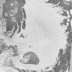 The genomandibular gland of <i>Nasonia giraulti </i>(Hymenoptera: Pteromalidae), SBFSEM.