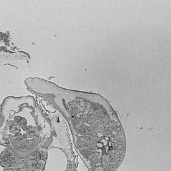 SBFSEM of the mandible of <i>Nasonia giraulti </i>showing the basimandibular and genomandibular glands.