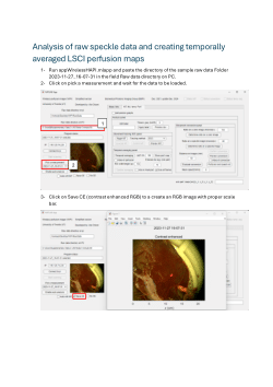 Supplementary Code 2 LSCI