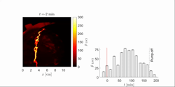 Video 3 Spatiotemporal perfusion of lobe 5 measured by laser speckle contrast imaging
