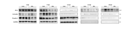 <b>Nephropathogenic infectious bronchitis virus induced inflammation and damaged intestinal barrier in Hy-Line brown chickens</b>