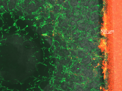 Embolization of a vascularized tumor model using a bead-based embolic agent