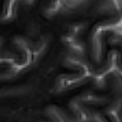 MRI dataset