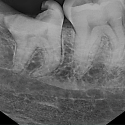 <b>Precise Classification of Oral Diseases</b>