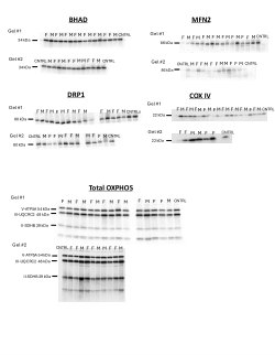 _Supplementary - Western Blotting.pdf