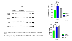 <b>Therapeutic effect of Histone deacetylase 6 inhibitor for a mouse model of Phenylketonuria</b>