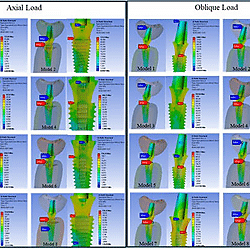 Stress distribution on implant components under axial and oblique loading