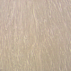 Figure 1A