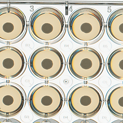 <b>Effects of simulated microgravity on biological features and virulence of the fungal pathogen </b><b><i>Cryptococcus neoformans</i></b>