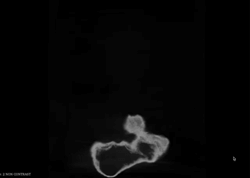 Berger et al 2025 eLife Hill Antechamber block visualization.movSupporting material for Homo naledi burial