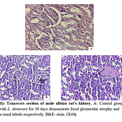 Visceral Leishmaniasis affecting some physiological and histological nature of kidney and spleen in male albino rats
