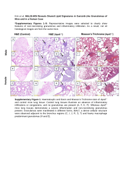 MALDI-MSI Reveals Shared Lipid Signatures in Sarcoid-Like Granulomas of Mice and in a Human Case<b> </b><b>Kim et al. </b><b>Supplemental Material 1. </b>