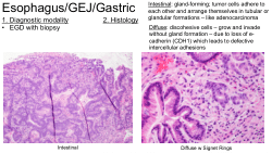 GI Path 101, Part 2 - Esophagus, GEJ, Gastric