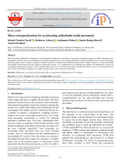 Micro-osteoperforation for accelerating orthodontic tooth movement