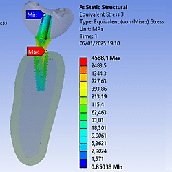 Stress distribution on implant components on each models under axial and oblique loading
