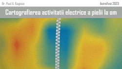 Activitatea electrică a pielii ca predictor pentru debutul diabetului de tip II