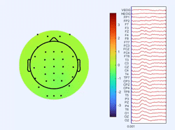 ERP evidence for the facilitation of typical translation equivalents in bilingual processing - DATASET