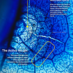 Symptom and Microscopic Visualization of the Advancing Margin and Necrotic Zone in Fungal Infection