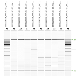 Capillary electrophoresis and Sanger Sequencing results