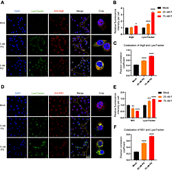 Supplemental material of "<b>A gut commensal </b><b><i>Serratia marcescens</i></b><b> inhibits dengue virus infection via prodigiosin-induced autophagy in </b><b><i>Aedes albopictus</i></b>"