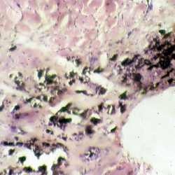 Histology & Pathology Slide Collection (Digitised 35 mm Slides & Microscopy Preparations)