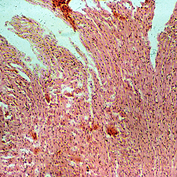 Histology & Pathology Slide Collection (Digitised 35 mm Slides & Microscopy Preparations) - Part 2