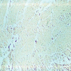 Histology & Pathology Slide Collection (Digitised 35 mm Slides & Microscopy Preparations) - Part 3