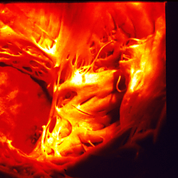 Platelets and Thrombosis - Boehringer Ingelheim/Persantin 100