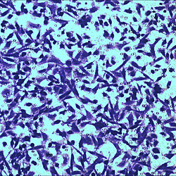 GRB2 promotes brain metastasisin HER2-positive breast cancer byregulating the Ras/MAPK pathway
