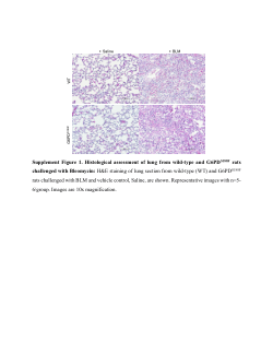 <b>Bleomycin-induced lung fibrosis and dysfunction is exacerbated by G6PD deficiency</b>