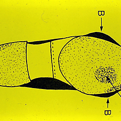 35 mm Podiatry Slides - Part 2