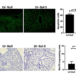 Galectin-3 in influenza infection