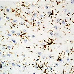<b>Therapeutic Antitoxoplasmosis</b> <b>Potential of </b><b><i>Garcinia cambogia</i></b><b>: Evidence from in silico and in vivo studies</b>