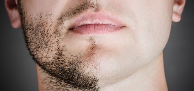 no-beard-day