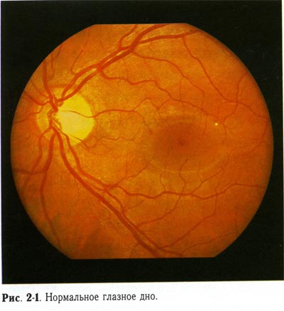 Нормальное глазное дно.