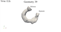 Duodenum geometry deformation patterns
