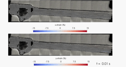 Volumetric Characterisation of Contracting Cardiac Trabeculae: Tracking Tissue Movement