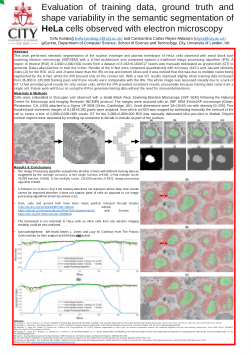 Segmentation of HeLa cells