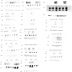 Mammalian orthoreovirus and HER2+ breast cancer