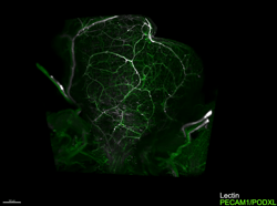 Supplemental video S2: Dorsal midline artery of the mouse urinary bladder